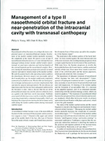 Management of a Type II Nasoethmoid Orbital Fracture and Near Penetration of The Intracranial Cavity with Transnasal Canthopexy